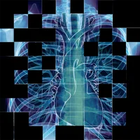 Chest X-Ray Interpretation